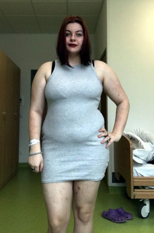 Plno�t�hl� modelky, plus size modelka, baculky, 995-DF1F8ACC-1578-4BEA-AA5F-671469373420